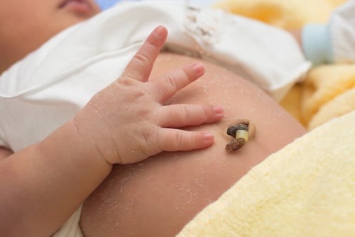 Một số bệnh lý liên quan đến rốn của trẻ sơ sinh