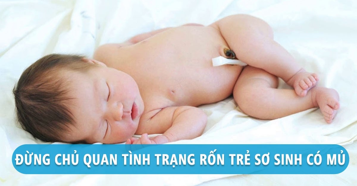 Trẻ sơ sinh có mủ ở rốn do rất nhiều nguyên nhân