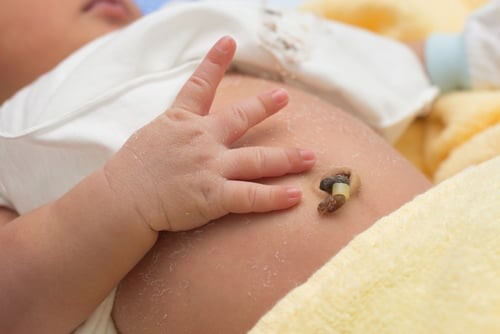 Hình ảnh rốn trẻ sơ sinh bình thường sau khi khô