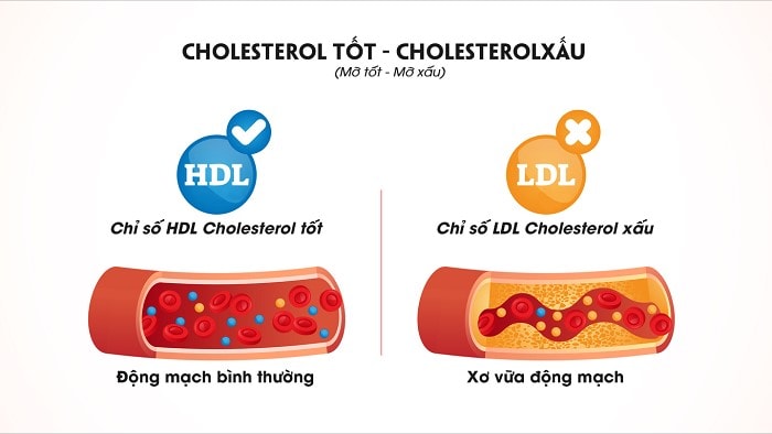 Trẻ thừa kẽm Cholesterol HDL sẽ thấp